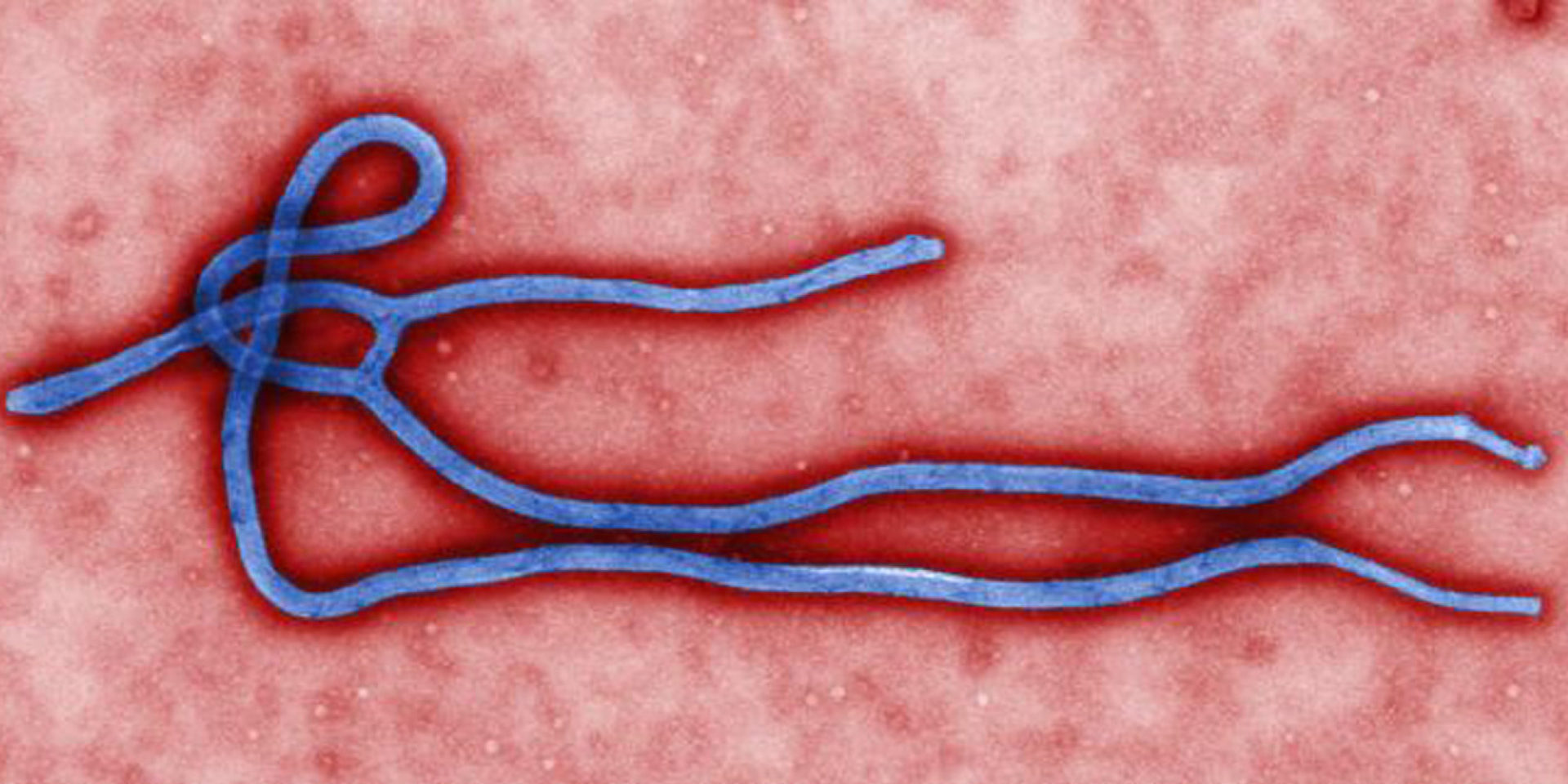 Robots to Fight Ebola