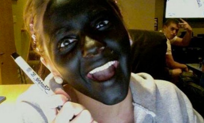 Permanent Black Face Staining With a Sharpie Marker