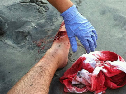 Sharks on South Carolina Beach