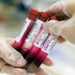C2N Diagnostics has started selling the First Blood Test of Alzheimer’s Disease in the US
