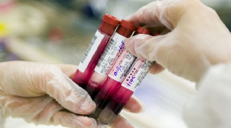 C2N Diagnostics has started selling the First Blood Test of Alzheimer's Disease in the US
