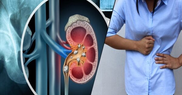 How to Maintain Kidney Health