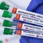 Monkeypox Outbreak in the US