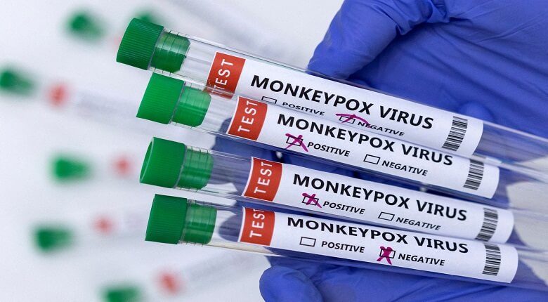 Monkeypox Outbreak in the US